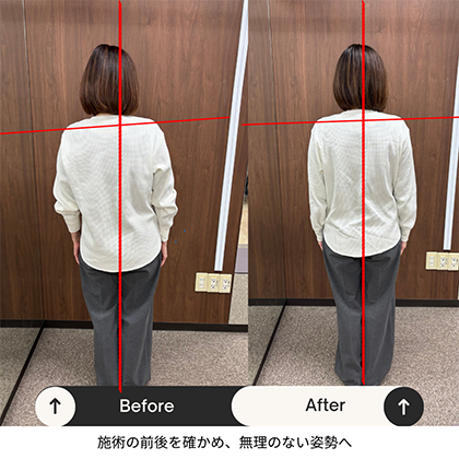 姿勢のBefore/After
